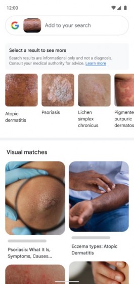 Google Lens新增皮肤健康检测功能